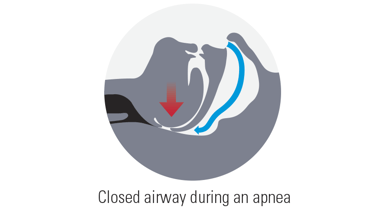 OSA_diagram